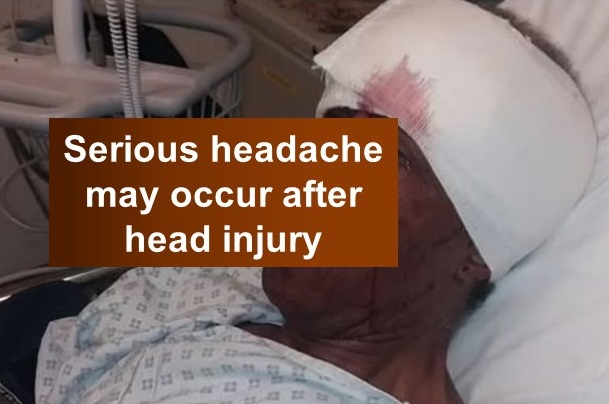 Headache occurring after head injury could be seriuos