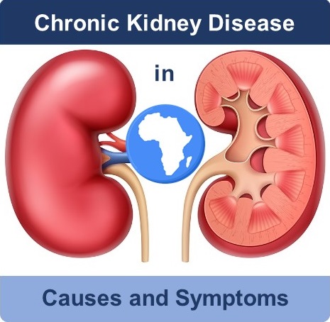 Chronic kidney disease