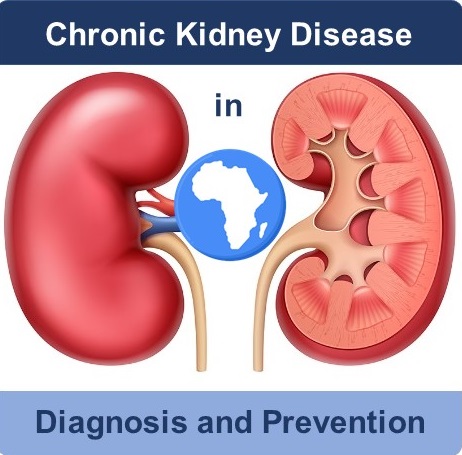 Chronic kidney disease in Africans: Diagnosis and Prevention