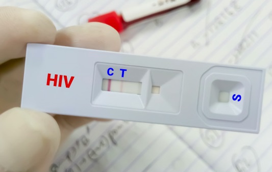 HIV screening test