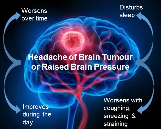 Headache worsened by coughing, sneezing and straining is serious