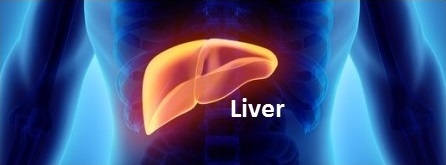 Hepatitis is a leadingcause of liver cancer globally