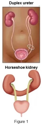 Kidney abnormalities