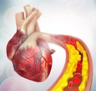 Cholesterol-and-heart- health