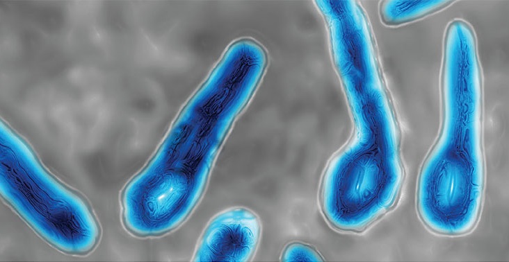 Colour enhanced microscopic image of Clostridium tetani