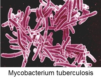 Microscopic image of Mycobacterium tuberculosis