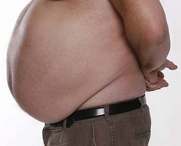 Obese male torso