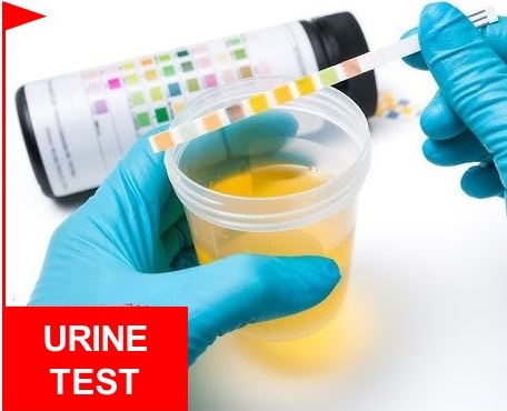 Urine test