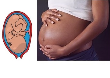 Full vertex. Normal baby position in pregnancy